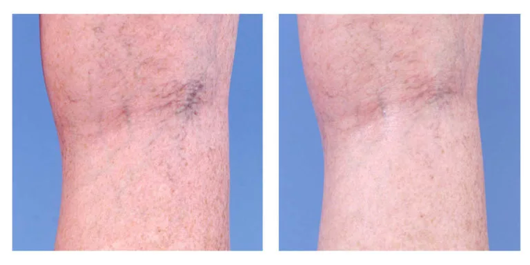 Kosmetinė korekcija